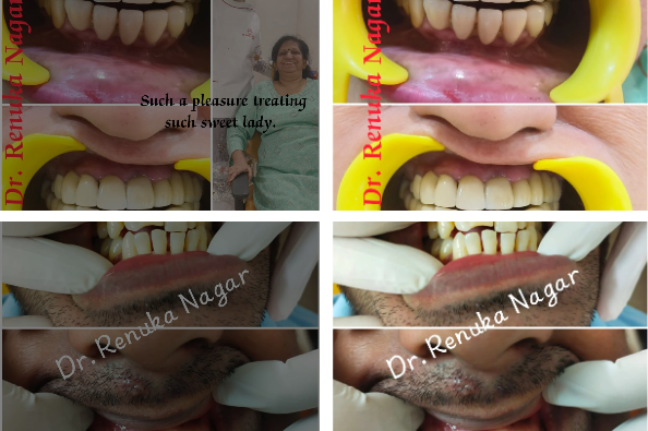 Best dental clinic in Saket