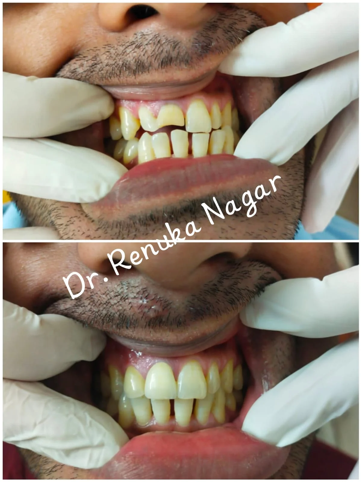 Dental Care Clinic in Saket, South Delhi