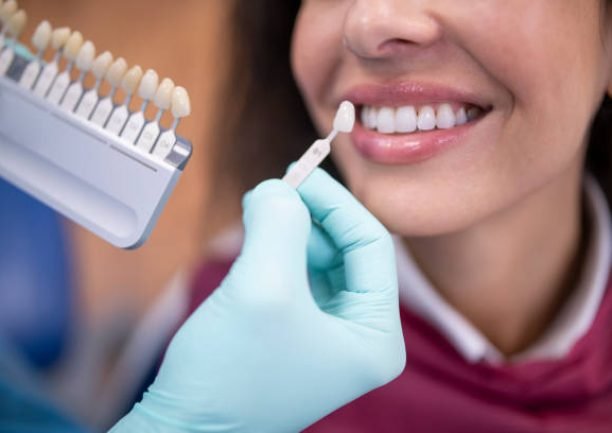 Dentist uses a palette tooth color sample to determine shade of patient's teeth.